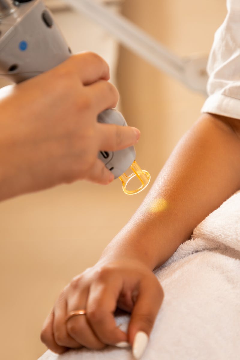 Close-up of a laser hair removal session at a spa, emphasizing professional skincare and relaxation.